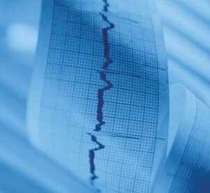 Overige ECG toebehoren