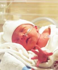 Neonatale ECG Electroden