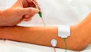 EMG Naaldelectroden