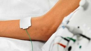 Disposable Adhesive Electrodes