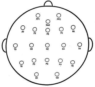 TinCap, Standaard 10-20 layout, D-Sub