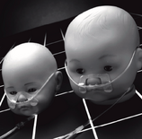 Tender grip, Newborn, skin fixation