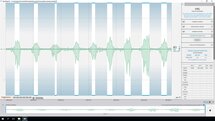 Electromyography (EMG) Analysis