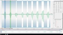 Electromyography (EMG) Analysis