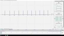 Heart Rate Variability (HRV)
