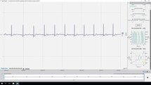 Heart Rate Variability (HRV)
