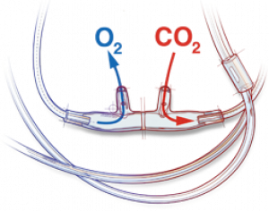 Pediatric divided cannula, 7'