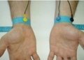 EKG-Sensor mit Armbändern
